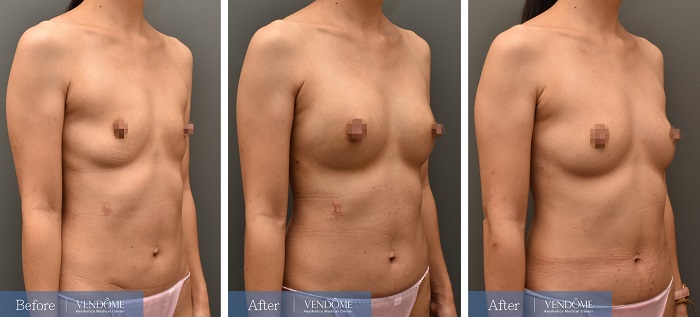 BA_ (15)